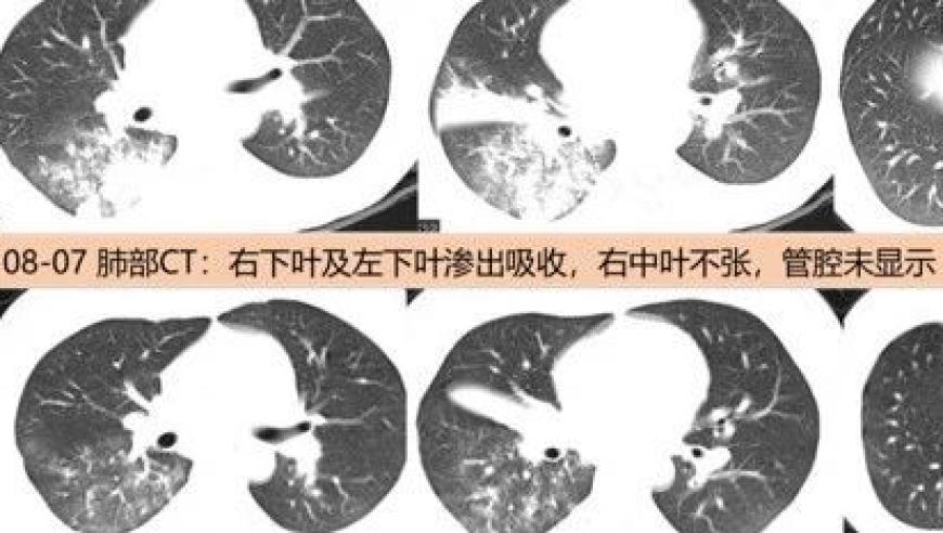 0149003com查询澳彩资料,当老师说跳远成绩算脚后跟,广泛的解释落实方法分析_枚举版V7.42